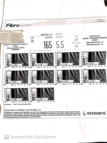 174.Fibroscann