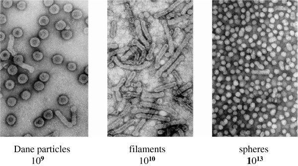 Electron-microscopy-images-negative-staining-and-approximate-numbers-of-HBV-associated_W640